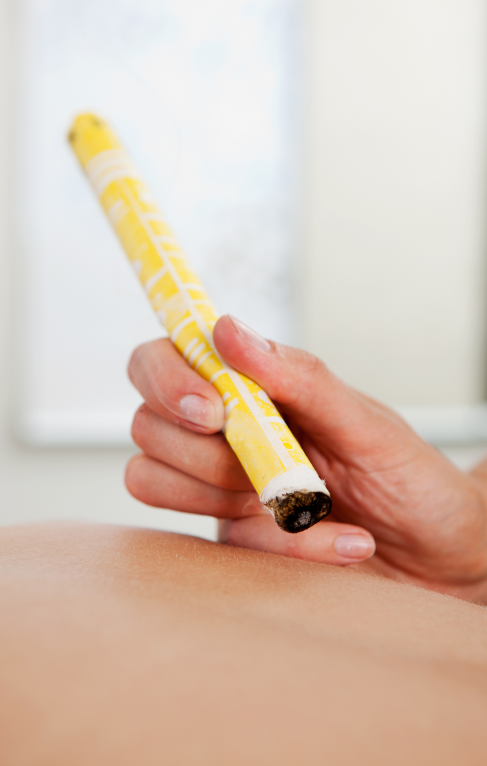 Moxibustion